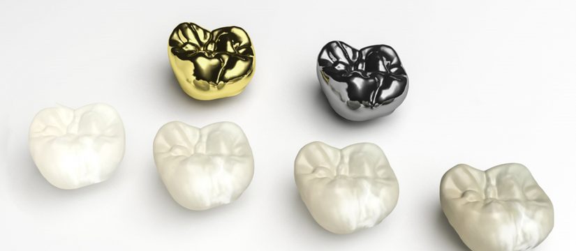 lose a dental crown