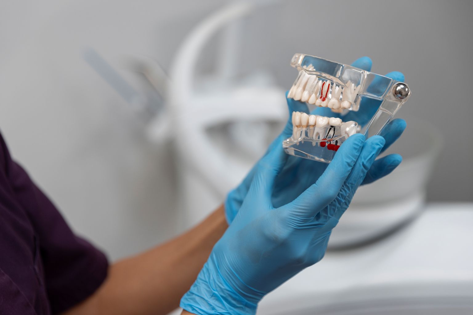 How Dental Implants Protect Your Oral Health Long-Term