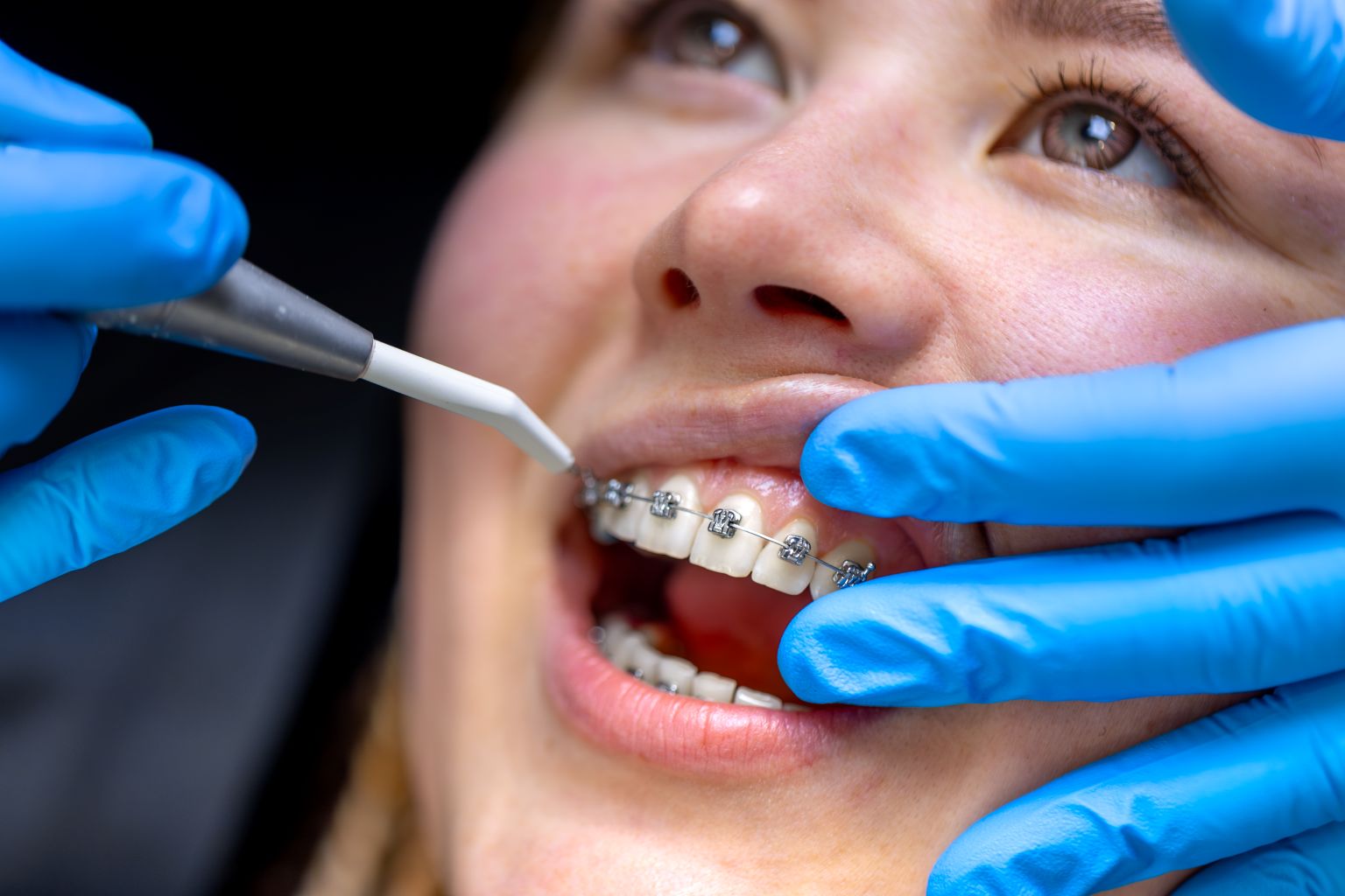 How Orthodontics Enhances Your Smile Aesthetics